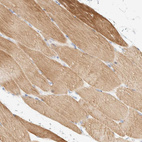 Immunohistochemical staining of human skeletal muscle shows moderate cytoplasmic positivity in myocytes.