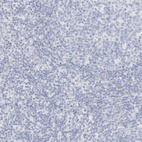Immunohistochemical staining of human lymph node shows no positivity in germinal center cells as expected.
