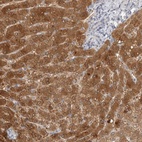 Immunohistochemical staining of human liver shows high expression.