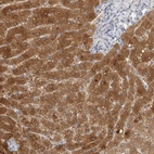 Immunohistochemical staining of human liver shows high expression.