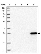 Lane 1: Marker [kDa] 230, 130, 95, 72, 56, 36, 28, 17, 11_br/_Lane 2: Human cell line RT-4_br/_Lane 3: Human cell line U-251MG sp_br/_Lane 4: Human plasma (IgG/HSA depleted)_br/_Lane 5: Human liver tissue