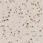 Immunohistochemical staining of human cerebral cortex shows strong nuclear positivity in neurons.