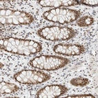 Immunohistochemical staining of human rectum shows strong nuclear positivity in glandular cells.