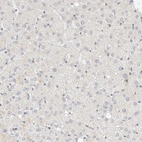 Immunohistochemical staining of human liver shows no positivity in hepatocytes as expected.