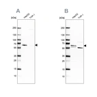 Anti-CDR2 Antibody