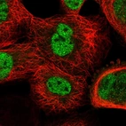 Immunofluorescent staining of human cell line A-431 shows localization to nucleoplasm.