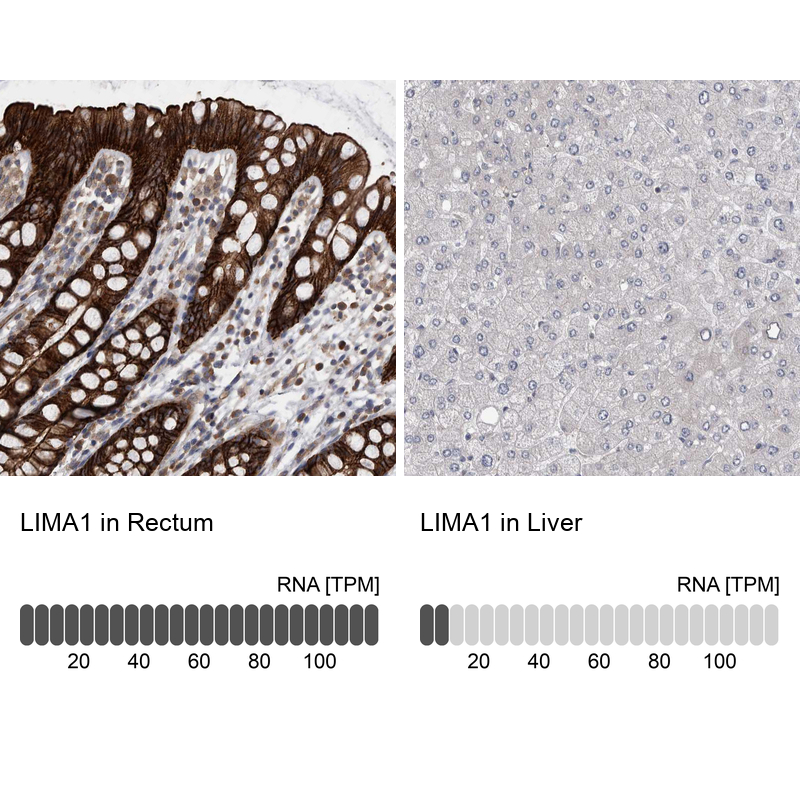 Anti-LIMA1 Antibody