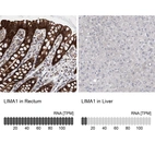 Anti-LIMA1 Antibody