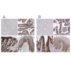 Immunohistochemical staining of human liver, prostate, rectum and squamous epithelia using Anti-LIMA1 antibody HPA023871 (A) shows similar protein distribution across tissues to independent antibody HPA052645 (B).