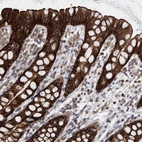 Immunohistochemical staining of human rectum shows strong membranous and cytoplasmic positivity in glandular cells.