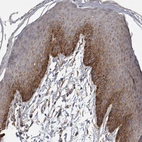 Immunohistochemical staining of human skin shows moderate membranous and cytoplasmic positivity in squamous epithelial cells.