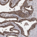 Immunohistochemical staining of human prostate shows strong membranous positivity in glandular cells.
