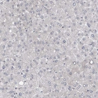 Immunohistochemical staining of human liver shows very weak membranous positivity in hepatocytes.