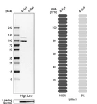 Western blot analysis in human cell lines A-431 and A-549 using Anti-LIMA1 antibody. Corresponding LIMA1 RNA-seq data are presented for the same cell lines. Loading control: Anti-PPIB.