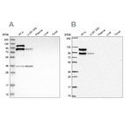 Anti-LIMA1 Antibody