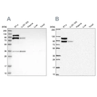 Western blot analysis using Anti-LIMA1 antibody HPA023871 (A) shows similar pattern to independent antibody HPA052645 (B).