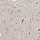 Immunohistochemical staining of human cerebral cortex shows weak to moderate cytoplasmic positivity in neurons.