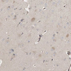 Immunohistochemical staining of human cerebral cortex shows weak to moderate cytoplasmic positivity in neurons.