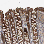 Immunohistochemical staining of human gastrointestinal shows strong cytoplasmic positivity in glandular cells.