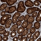 Immunohistochemical staining of human stomach shows strong cytoplasmic positivity in glandular cells.