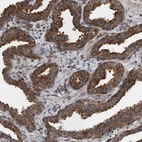 Immunohistochemical staining of human prostate shows strong cytoplasmic positivity in glandular cells.