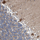 Anti-BAIAP2L1 Antibody