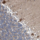Immunohistochemical staining of human cerebellum shows moderate cytoplasmic positivity in Purkinje cells.