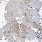 Immunohistochemical staining of human skeletal muscle shows very weak cytoplasmic positivity in myocytes.