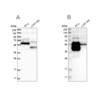 Anti-BAIAP2L1 Antibody