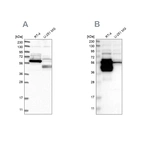 Western blot analysis using Anti-BAIAP2L1 antibody HPA023874 (A) shows similar pattern to independent antibody HPA019484 (B).