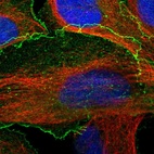 Immunofluorescent staining of human cell line U-2 OS shows localization to plasma membrane.