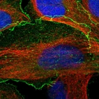 Immunofluorescent staining of human cell line U-2 OS shows localization to plasma membrane.