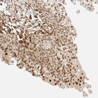 Anti-ARID5A Antibody