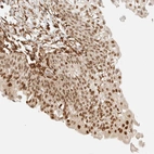 Anti-ARID5A Antibody