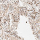 Immunohistochemical staining of human prostate shows moderate nuclear positivity in glandular cells.