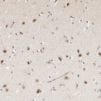 Immunohistochemical staining of human cerebral cortex shows strong nuclear positivity in neurons.