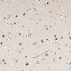 Immunohistochemical staining of human cerebral cortex shows strong nuclear positivity in neurons.