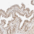 Immunohistochemical staining of human fallopian tube shows moderate nuclear positivity in glandular cells.