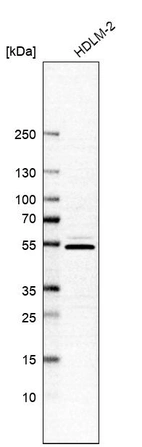 Western blot analysis in human cell line HDLM-2.