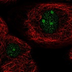 Immunofluorescent staining of human cell line A-431 shows positivity in nucleus & nucleoli.