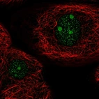 Immunofluorescent staining of human cell line A-431 shows positivity in nucleus & nucleoli.