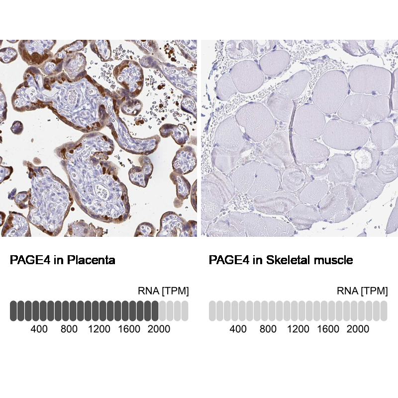 Anti-PAGE4 Antibody