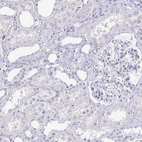 Immunohistochemical staining of human kidney shows no positivity in cells in tubules as expected.