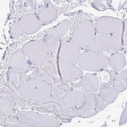 Immunohistochemical staining of human skeletal muscle shows no positivity in myocytes as expected.