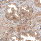 Anti-FAT1 Antibody