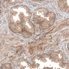 Anti-FAT1 Antibody