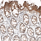 Immunohistochemical staining of human rectum shows strong membranous positivity in glandular cells.
