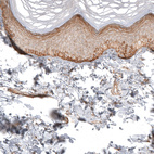 Immunohistochemical staining of human skin shows moderate membranous positivity in squamous epithelial cells.