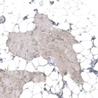 Immunohistochemical staining of human skeletal muscle shows very weak positivity in myocytes.