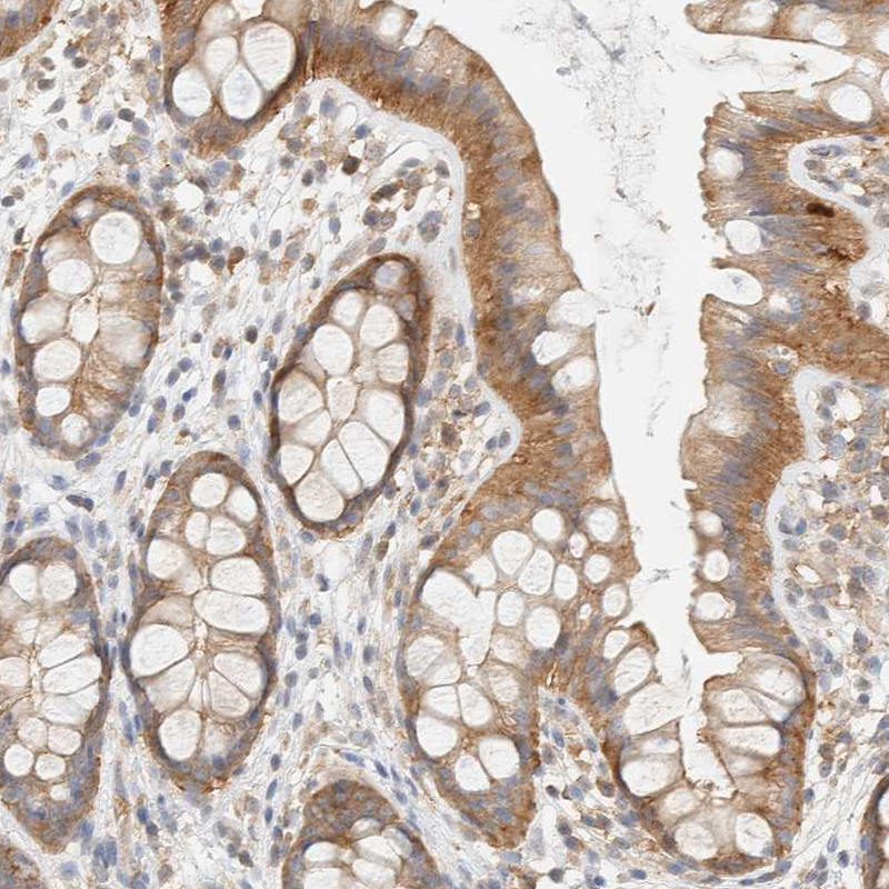 Anti-TBC1D8B Antibody